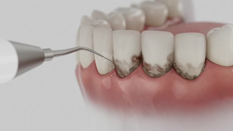 Reliable Dental Implants contractor in Goreville, IL by Smile Center Dentistry